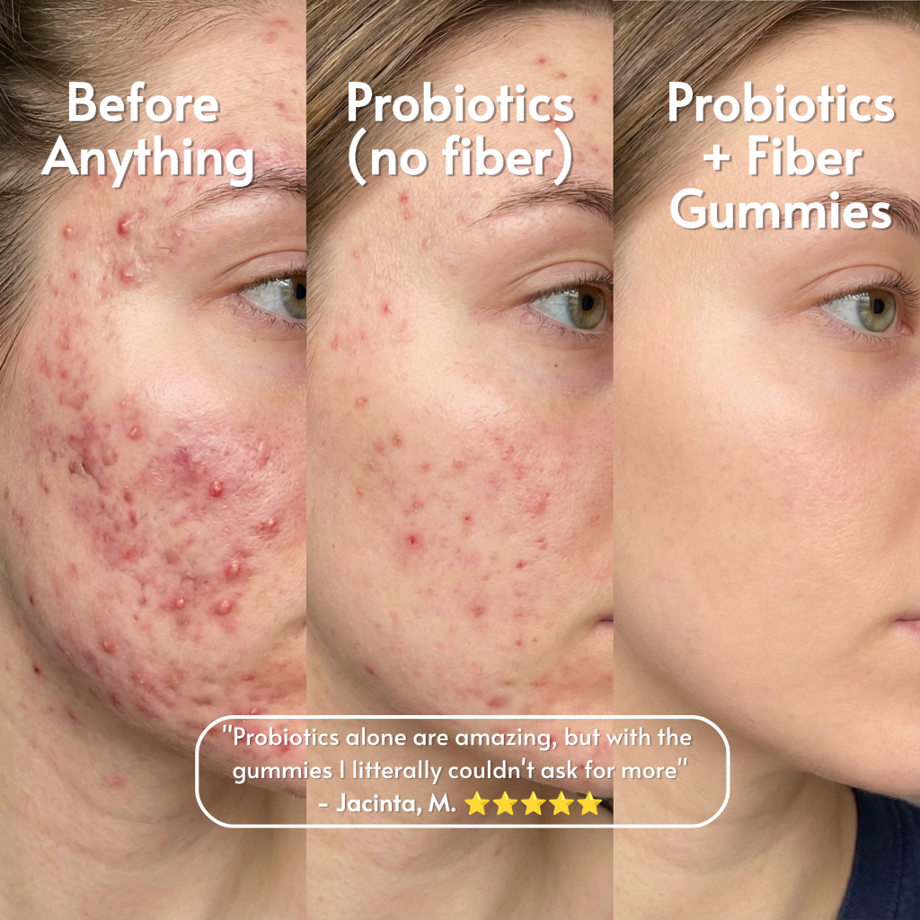 Fiber Gummies - Probiotic Energy