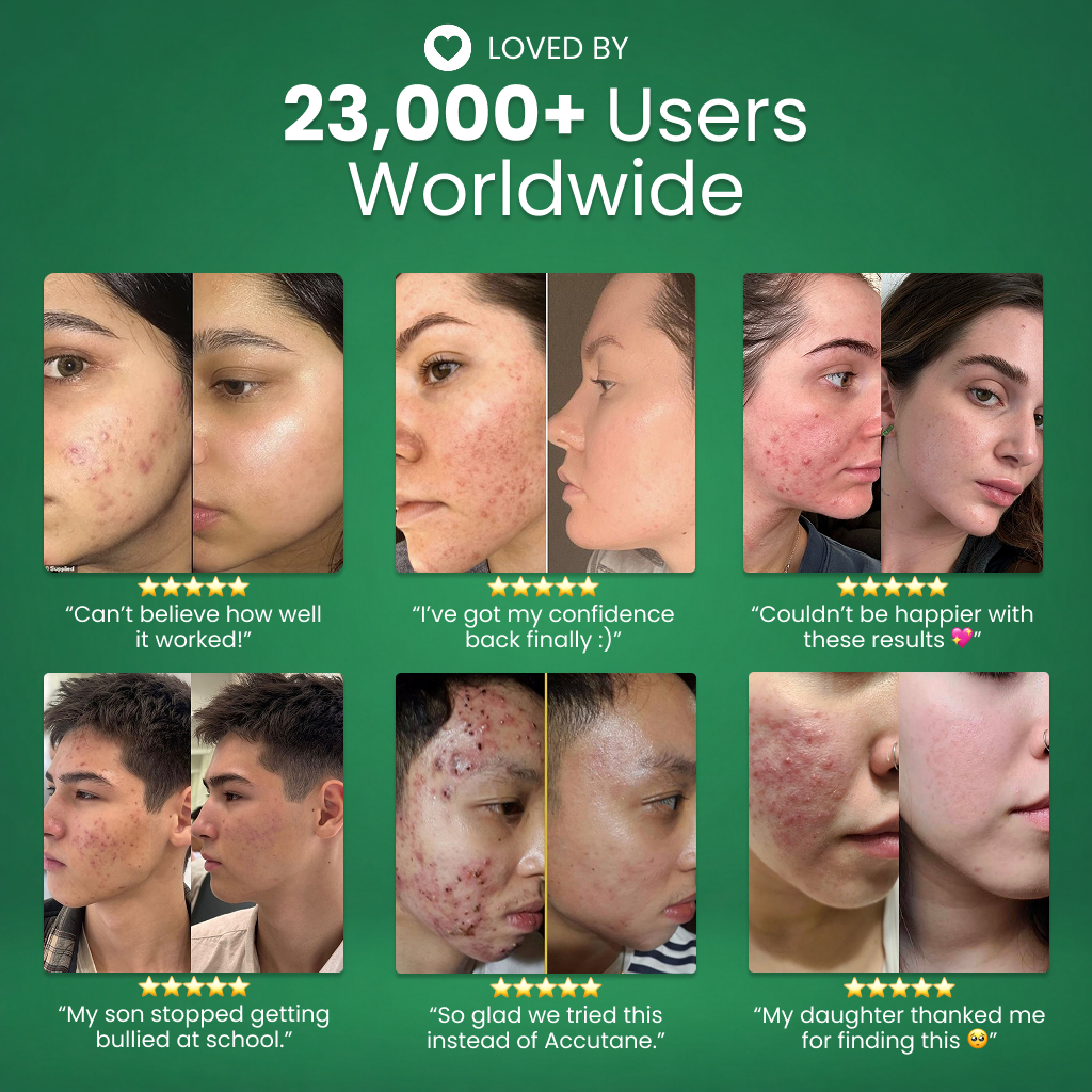 Skinfora Daily Gut-Skin Probiotic