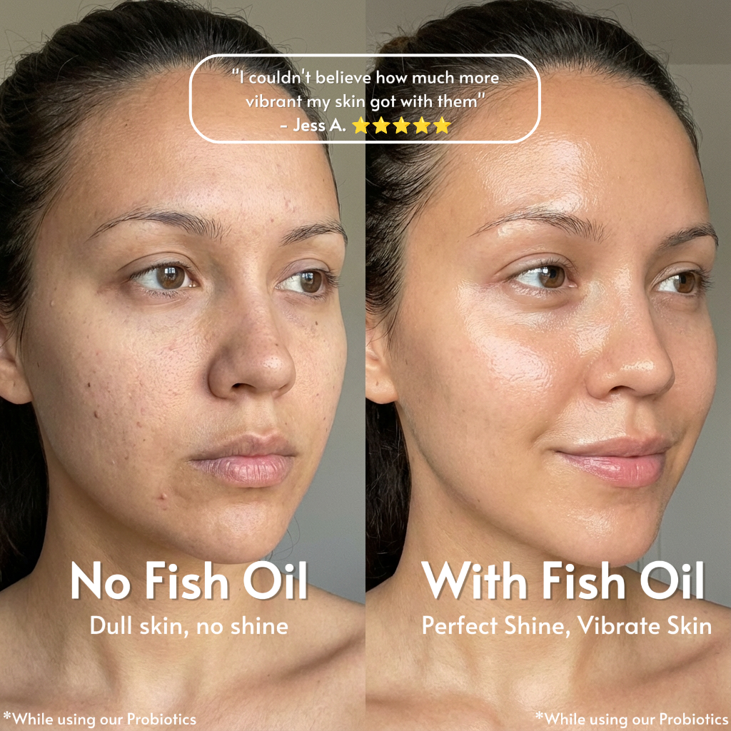 Skinfora Inflammation Support (Omega-3 Fish Oil)